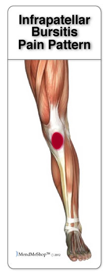 Pain around and below the knee cap is commonly caused by prepatellar or infrapatellar bursitis.