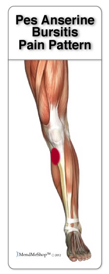 Pain to the lateral side of the knee cap is commonly caused by pes anserine bursitis.