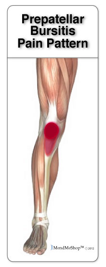 Pain below the knee cap is commonly caused by prepatellar bursitis.