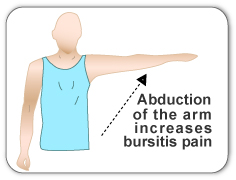 Shoulder bursitis can cause pain during activities requiring abduction of the rotator cuff.
